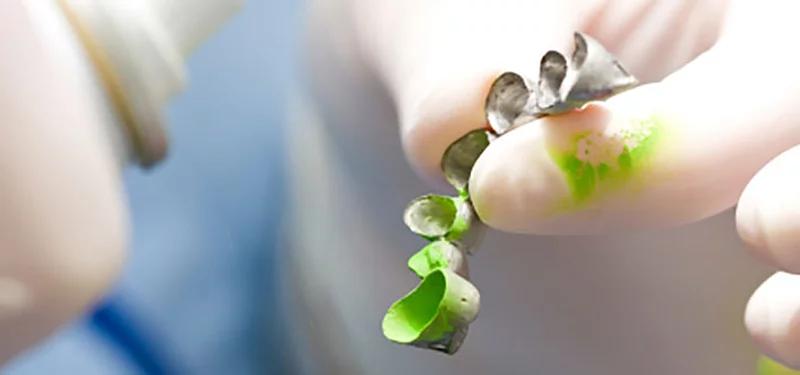 Okklusalspray und festsitzende Teilprothese