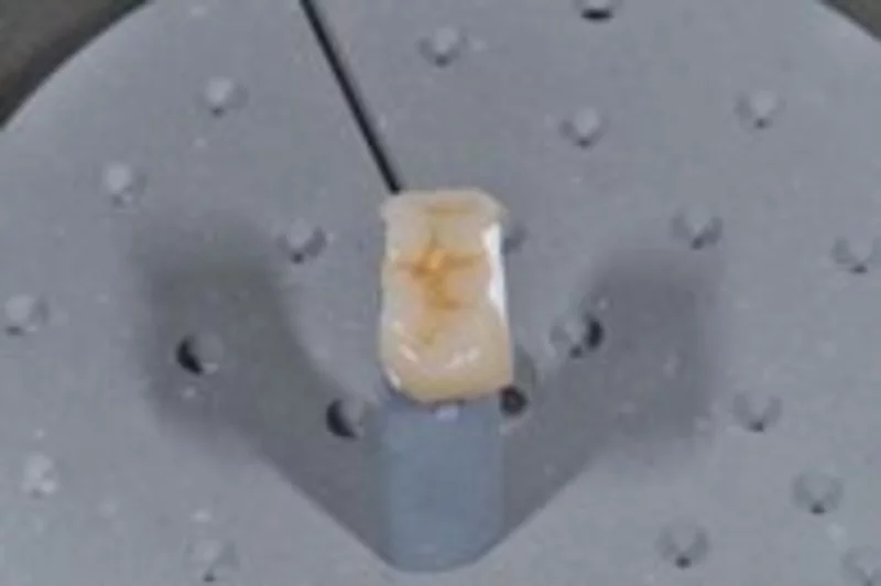 Abb. 5: e.max-Keramik nach dem Brennen in der endgültigen Zahnfarbe.