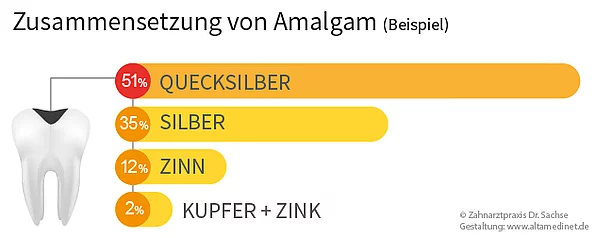 Ein Beispiel der Zusammensetzungvon Amalgam