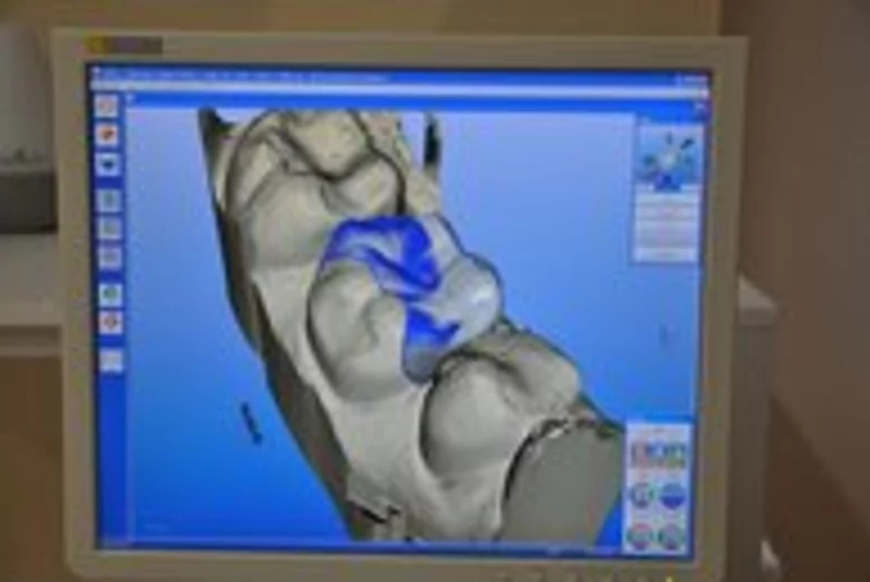 Abb. 1a - Abb. 1b: Die Versorgung wird am PC konstruiert.