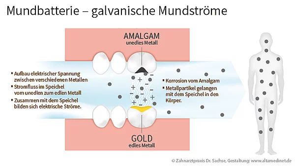 Die Mundbatterie mit ihren galvanischen Mundströme