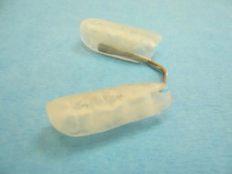 Eine Schiene für die Zähnen