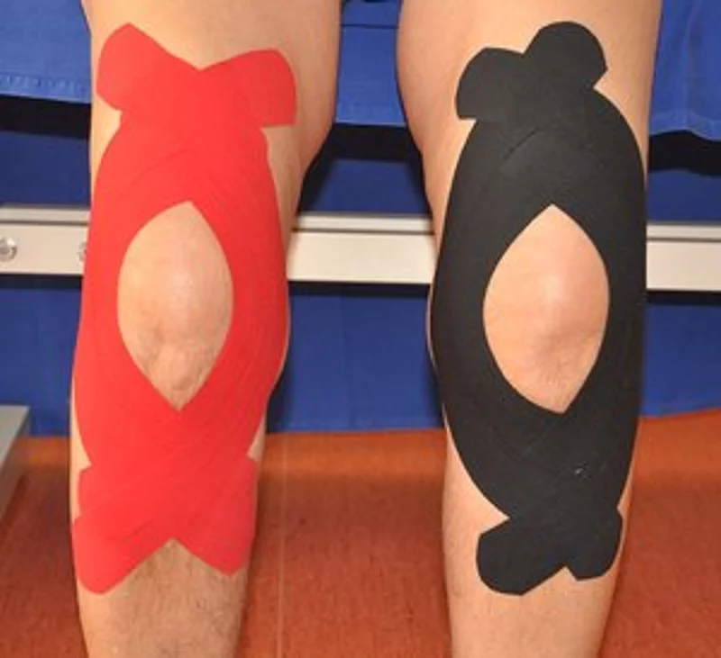 Meditaping am Kniegelenk