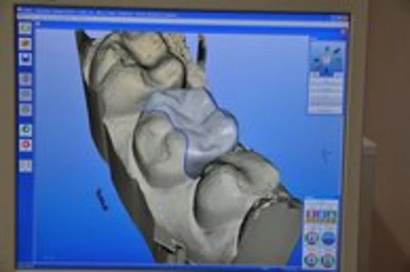 Abb. 1b - PC Konstruktion