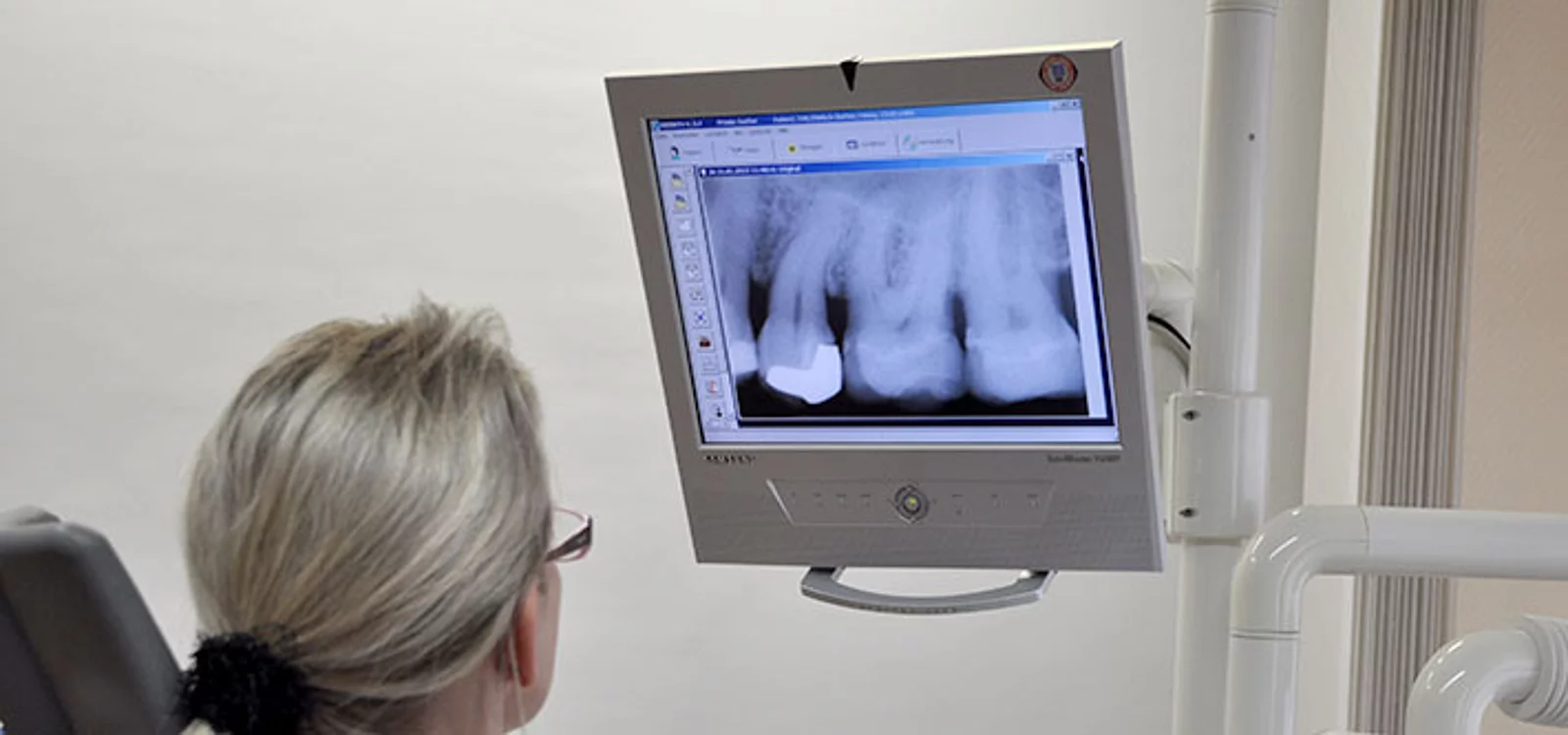 Röntgenbild in der Praxis