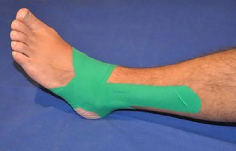 Meditaping am Fußgelenk