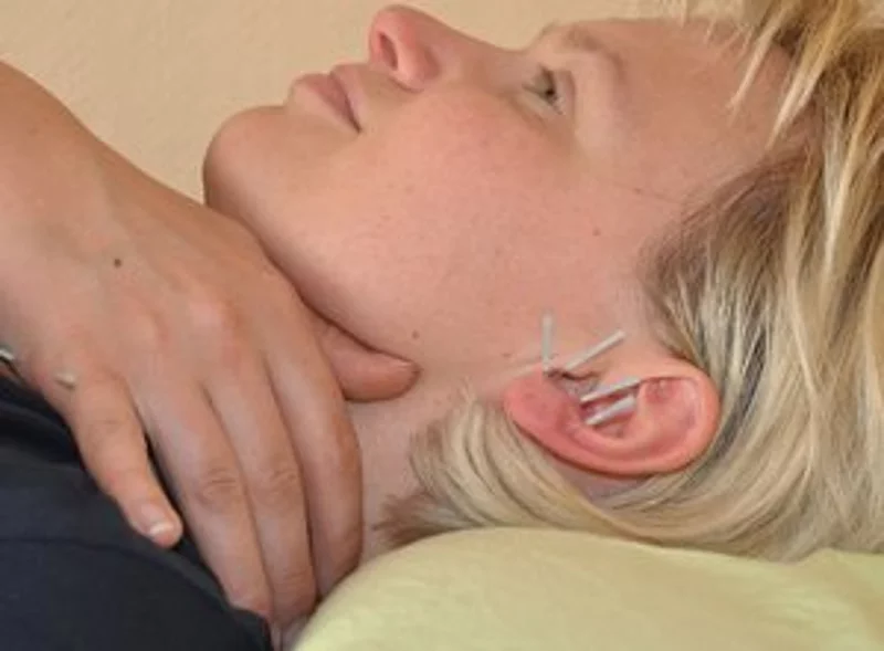 Ohr mit Akupunkturnadeln